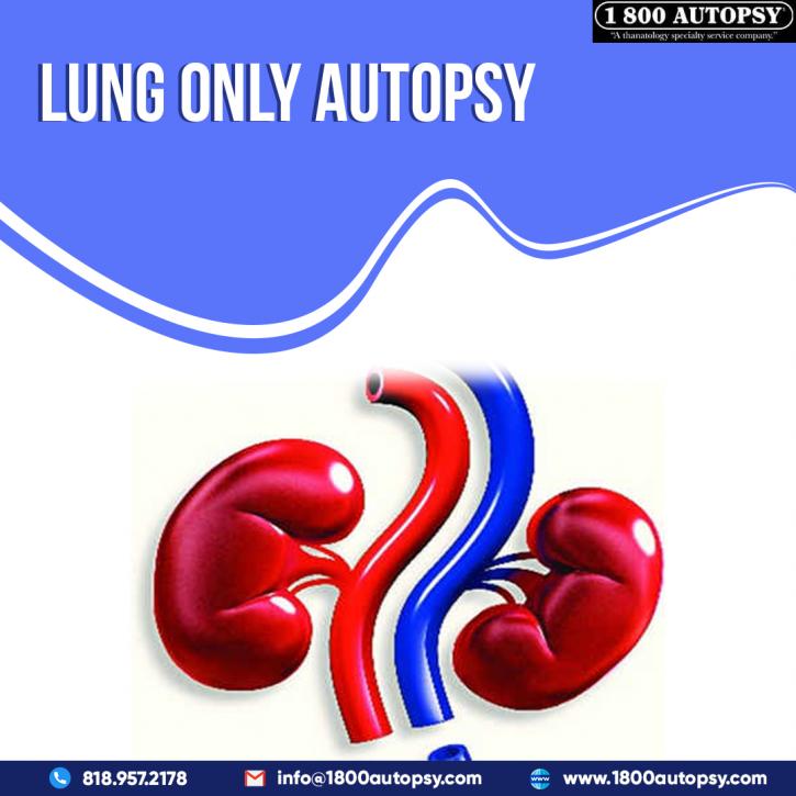Image for Lung Only Autopsy with ID of: 5054031
