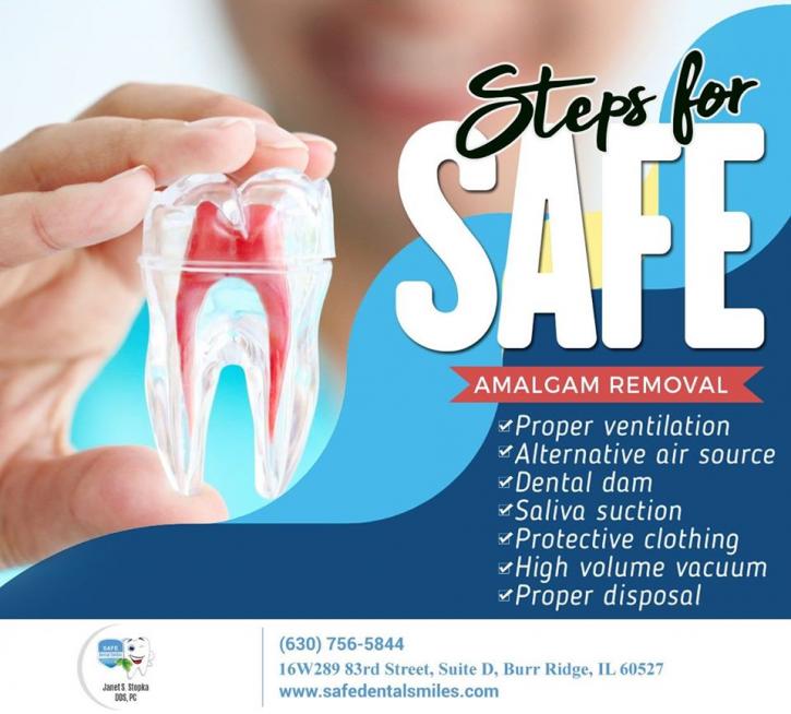 Image for Safe Mercury Amalgam Removal Burr Ridge IL with ID of: 5055242
