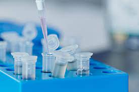 Image for Infectious Disease Diagnostics Testing Market Size, Demand, Growth And Industry Development Trends By 2021-2026 with ID of: 5055631