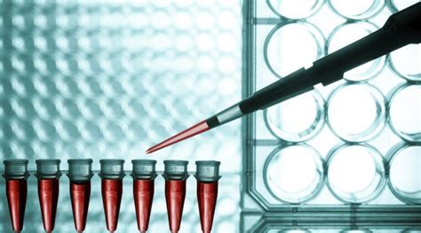 Image for Molecular Diagnostics For Cancer Testing Market Emerging Trends And Growth Analysis Report 2021-2027 with ID of: 5067845