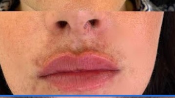 Image for Leah Bramley Aesthetics with ID of: 5078082