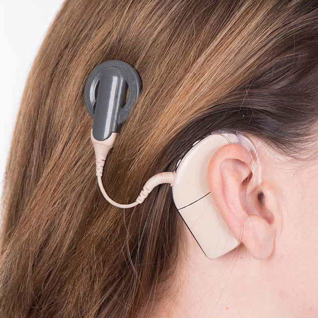Image for Cochlear Implants Market Emerging Trends And Growth Analysis Report 2021-2027 with ID of: 5089638