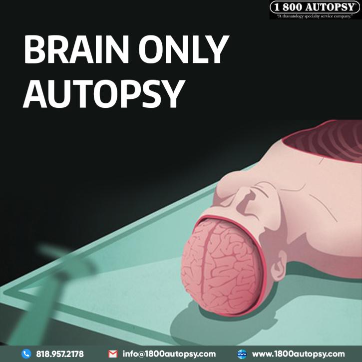 Image for Brain Only Autopsy with ID of: 5095418