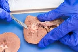 Image for Pathological Examination Market Size, Demand, Growth And Industry Development Trends By 2021-2026 with ID of: 5119422