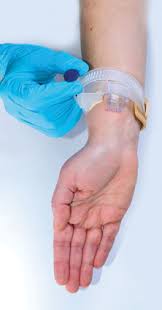 Image for External Hemostatic Device Market Size, Demand, Growth And Industry Development Trends By 2022-2028 with ID of: 5133903