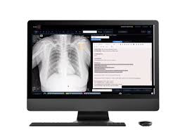 Image for AI-powered X Ray Imaging Market Share, Trends, Product Estimates & Strategy Framework To, 2022-2028 with ID of: 5203121