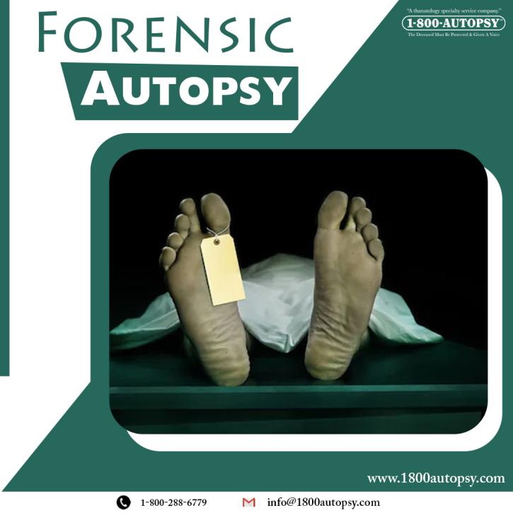 Image for Forensic Autopsy with ID of: 5210719