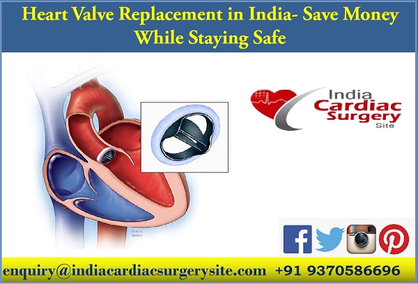 Image for Heart Valve Replacement in India with ID of: 5215280
