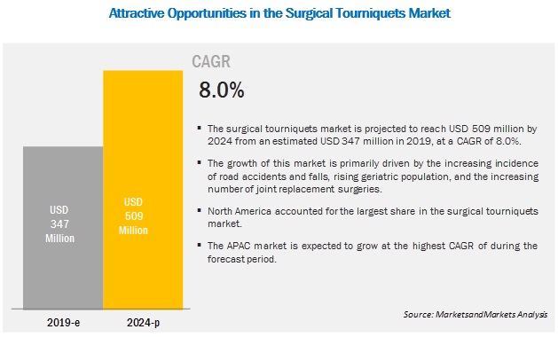 Image for How will the current technological trends affect the surgical tourniquets market in the long term? with ID of: 5221572