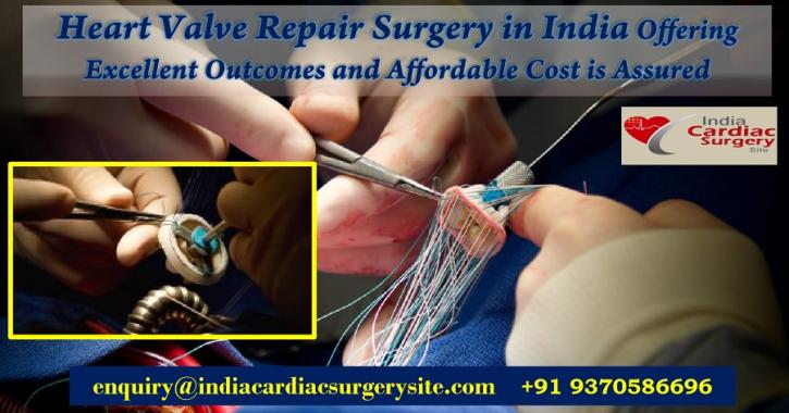 Image for heart valve repair India with ID of: 5262053