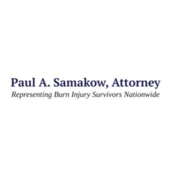 Image for National Burn Attorney with ID of: 5283103