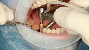 Image for Waldron Dental with ID of: 5300247