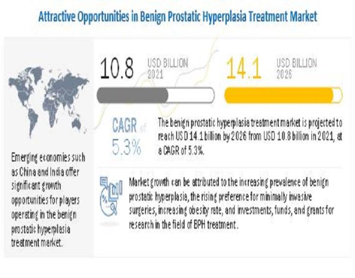 Image for Benign Prostatic Hyperplasia Treatment Market: Increasing prevalence of benign prostatic hyperplasia with ID of: 5315077