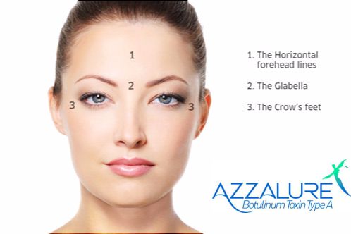 Image for Azzalure with ID of: 5338576