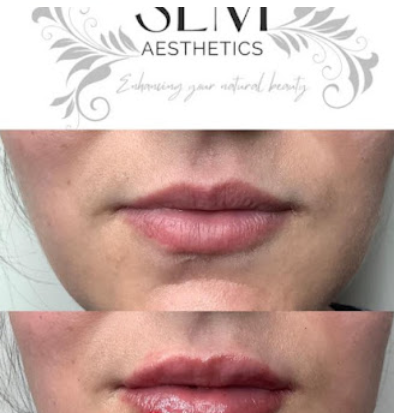 Image for SLM Aesthetics with ID of: 5349079