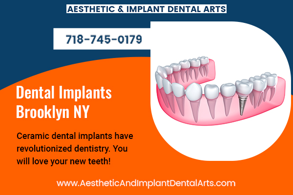 Image for Dental Implants Brooklyn NY with ID of: 5352382
