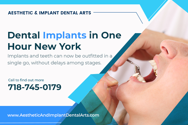 Image for Dental Implants in One Hour New York with ID of: 5393069