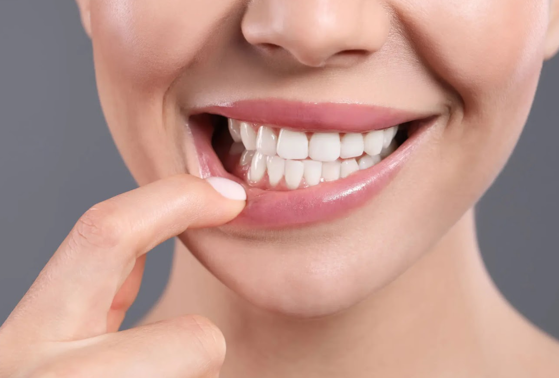 Image for The 7 Most Likely Culprits Behind Your Receding Gums with ID of: 5424758