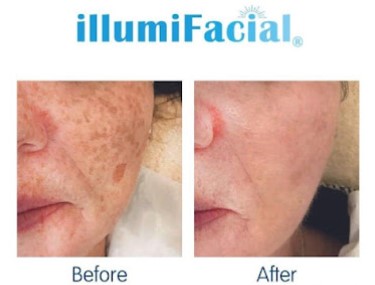 Image for Silky Skin with ID of: 5440169