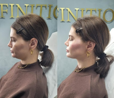 Image for Definition Aesthetics with ID of: 5455737