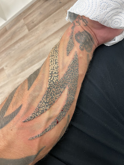 Image for Bristol Laser Removal Studio with ID of: 5536381