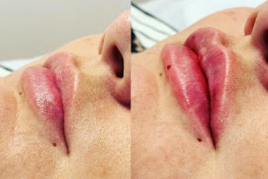 Image for SLS Clinic with ID of: 5564786