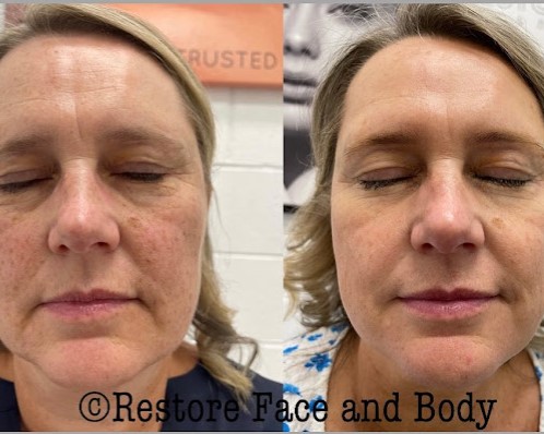 Image for Restore Face and Body with ID of: 5605992