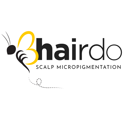 Image for Bhairdo Scalp Micropigmentation with ID of: 5621856