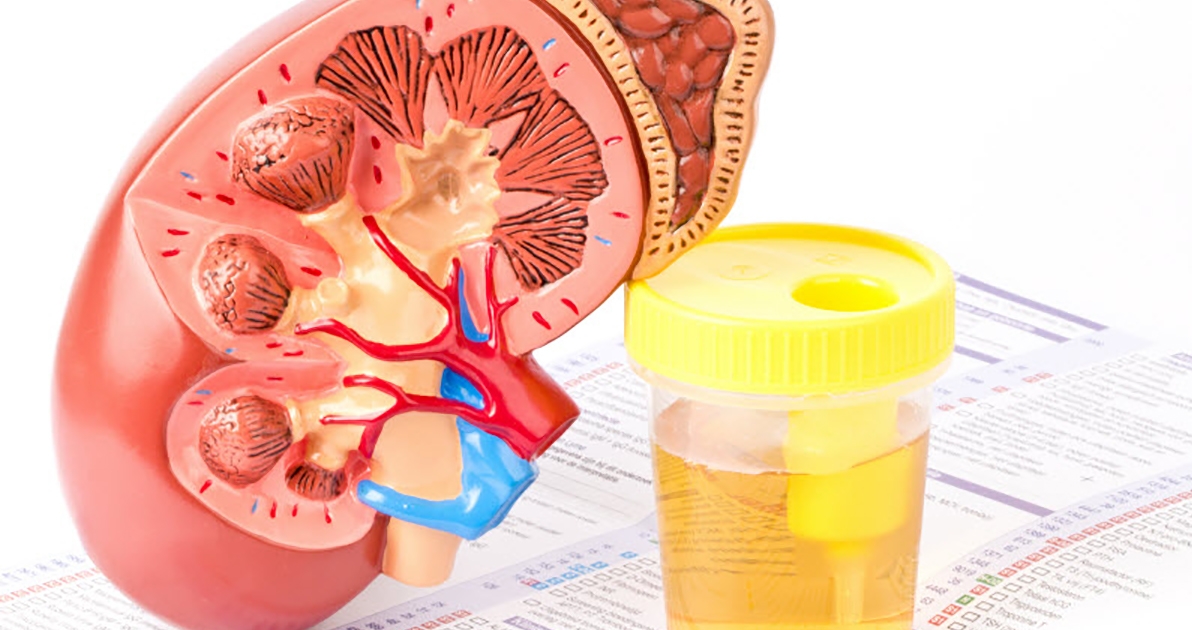 Image for Kidney Function Tests Market: Opportunities, Size and Growth Projections in Upcoming Years with ID of: 5634880