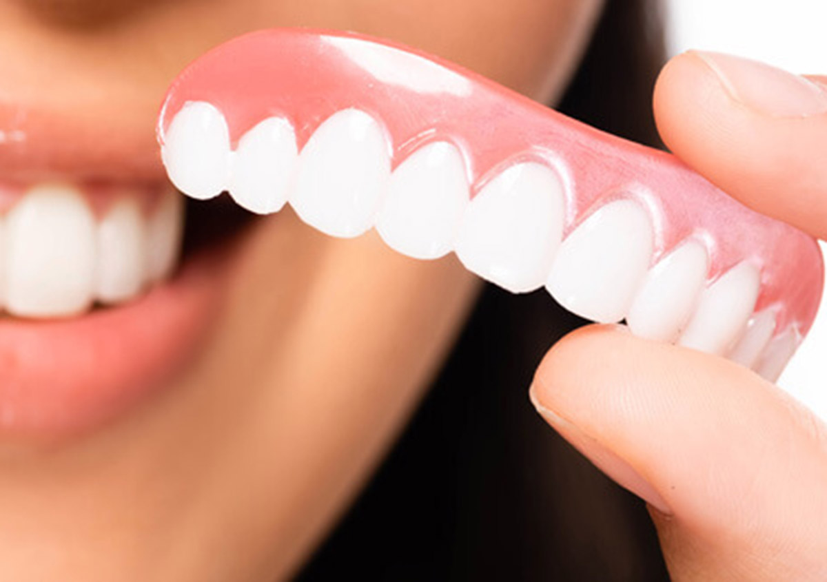 Image for False Teeth Market Share: Exploring Opportunities with Market Size and Growth Projections with ID of: 5640678