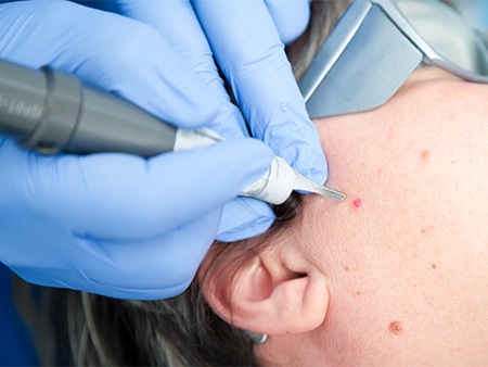 Image for Surgical Lasers Market: Predicted Rapid Growth With Trends, Competition, And Opportunity Analysis with ID of: 5671161