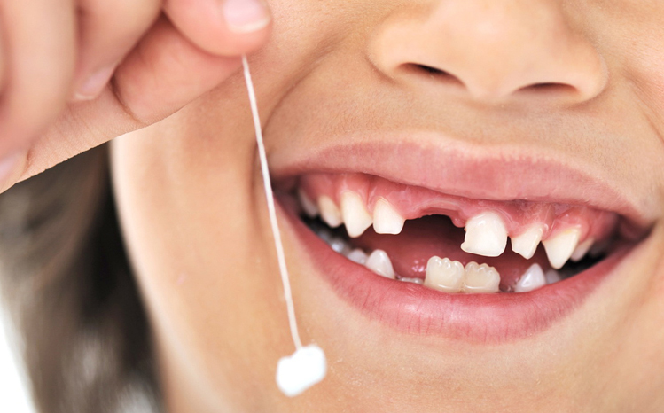 Image for When Is Necessary to Remove Your Child’s Milk Teeth? with ID of: 5676548