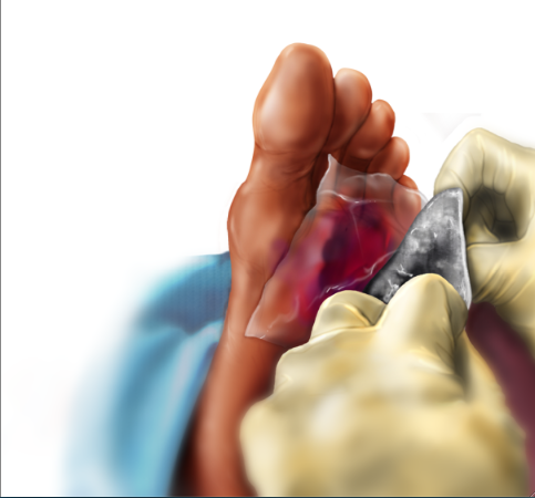 Image for Silver Based Wound Dressing Market - Opportunities and Challenges 2027 – Techsci Research with ID of: 5739832