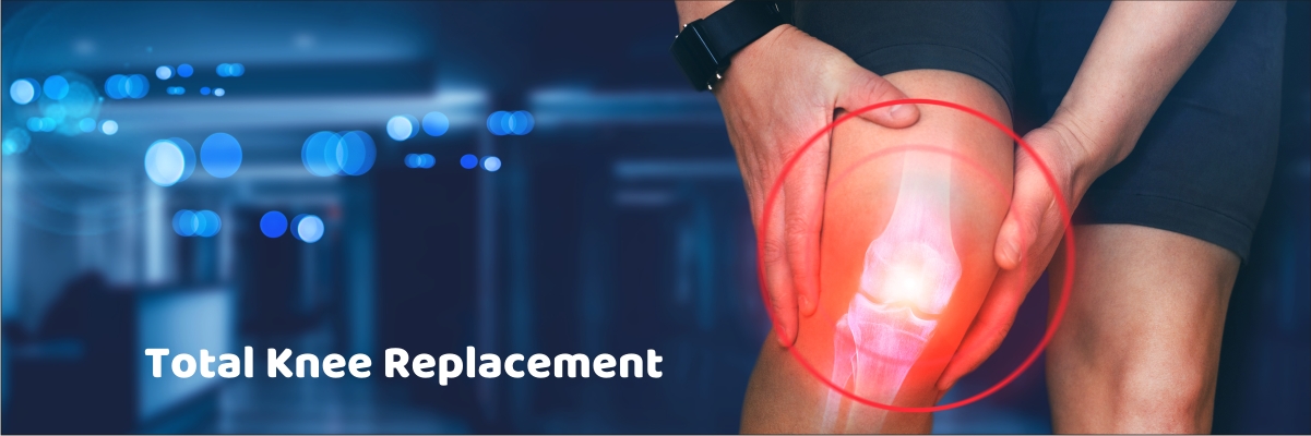Image for Total Knee Replacement Market: Trends and Forecast Insights for 2028 and Beyond with ID of: 5748997