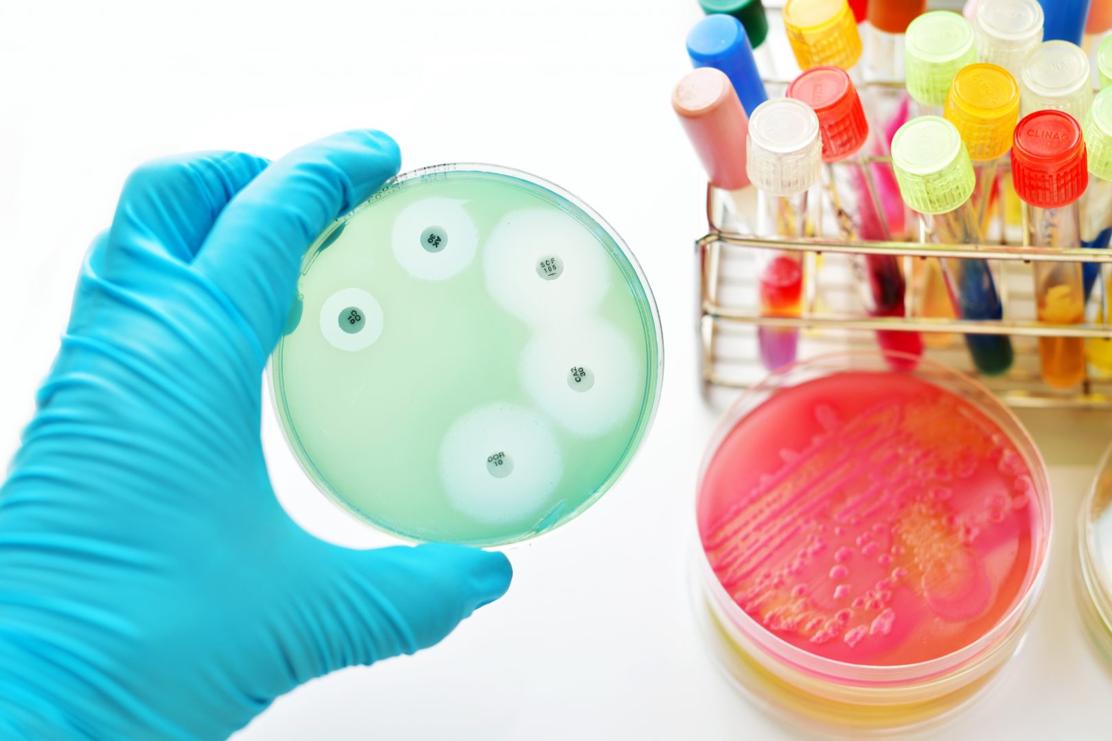 Image for Antimicrobial Susceptibility Testing Market: A Study of Key Players, Trends, and Forecast to 2028 with ID of: 5762585
