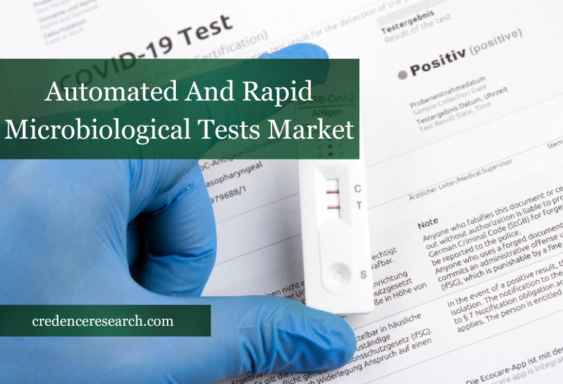 Image for Automated And Rapid Microbiological Tests Market- Future Growth Prospects for the Global Leaders with ID of: 5772980