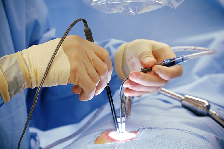 Image for India Bariatric Surgical Devices Market: In-Depth Analysis of Size, Share, and Growth - TechSci Research with ID of: 5838857