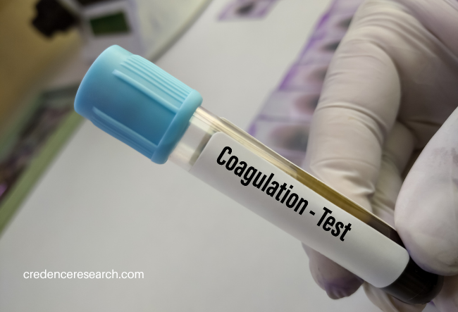 Image for Blood Coagulation Testing Market - Key Players, Growth and Opportunities 2030 | Credence Research with ID of: 5842864