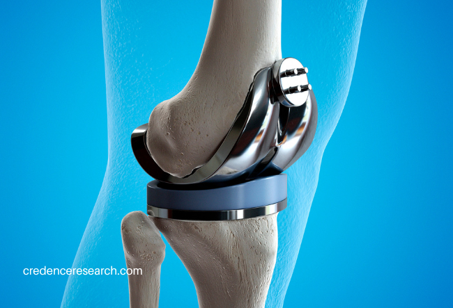 Image for Orthopedic Implants Market- Future Growth Prospects for the Global Leaders | Credence Research with ID of: 5845212