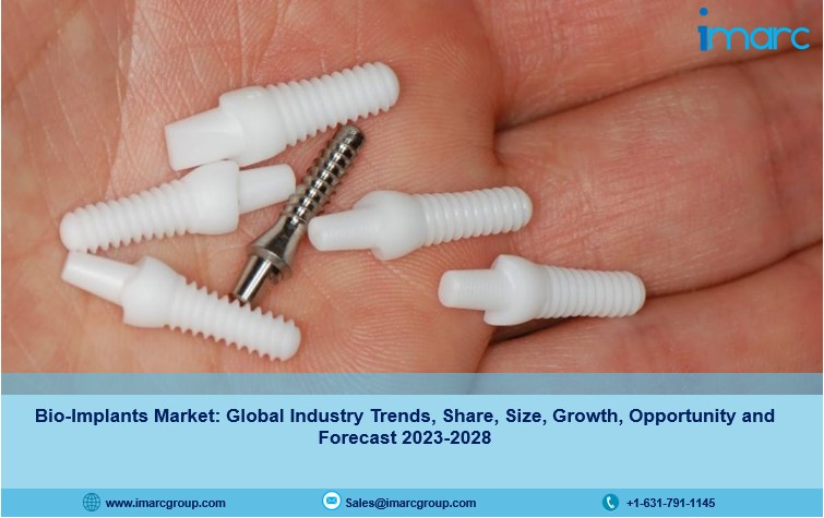 Image for Bio-Implants Market Share, Size, Growth and Forecast 2023-2028 with ID of: 5866836