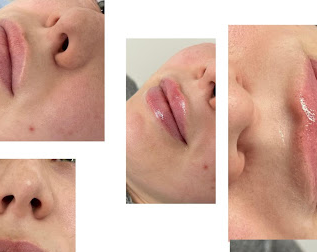 Image for Redream Cosmetics Advanced Aesthetics with ID of: 5871416