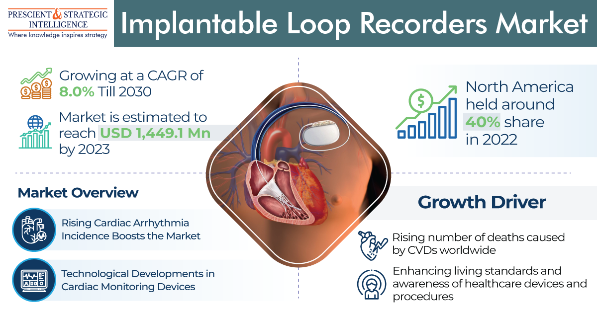Image for Implantable Loop Recorders Market Share, Growth and Forecast Report 2030 with ID of: 5874949