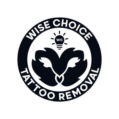 Image for Wise Choice Tattoo Removal with ID of: 5988646
