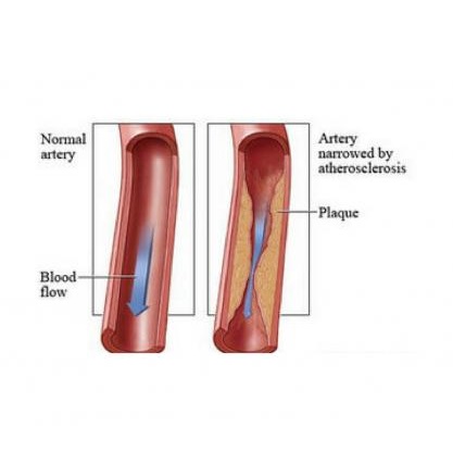 Image for USA Vascular Centers with ID of: 4396854