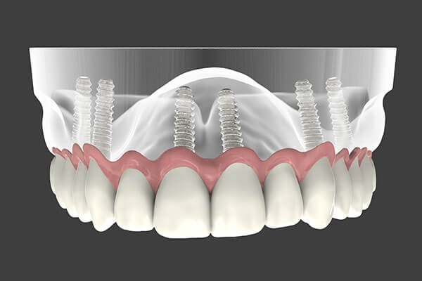 Image for Rangel Dental with ID of: 4436944