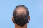Image for Dr. Parsa Mohebi with ID of: 4490877