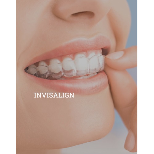Image for Tri Cities Orthodontic Specialists with ID of: 4529362