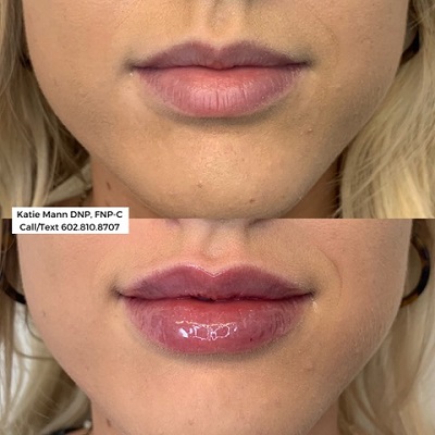 Image for Method Aesthetics Scottsdale with ID of: 4592057
