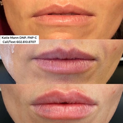 Image for Method Aesthetics Scottsdale with ID of: 4592058