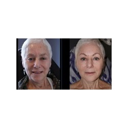 Image for Simplicity Medspa with ID of: 4620136